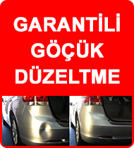 garantili-gocuk-duzeltme